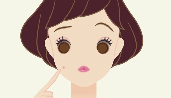 Acne, cheek, woman