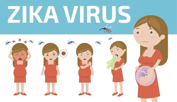 Zika virus infographic