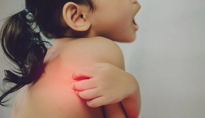 Health problem. asian young girl scratching her itchy back