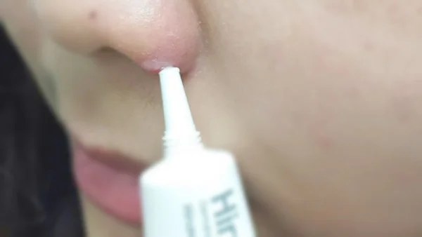 hiruscar-anti-acne-2