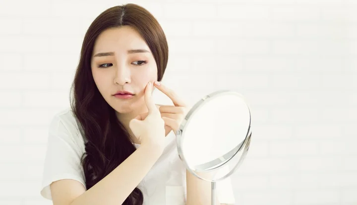 after-pressing-the-acne-should-take-care-of-this-skin