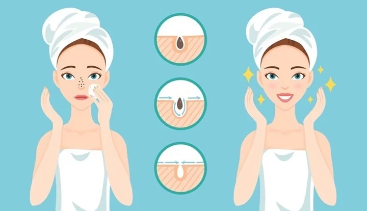 5-tips-to-get-rid-of-blackheads