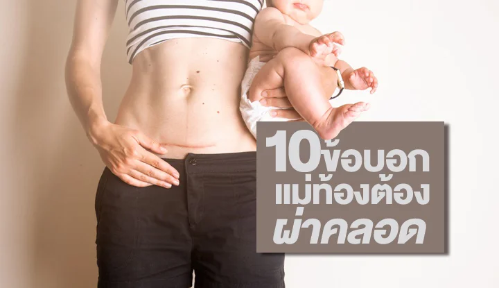 10-things-that-make-you-c-section