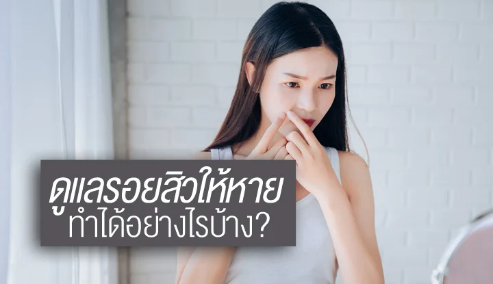 take-care-of-the-acne-marks-how-to-deal-with-it