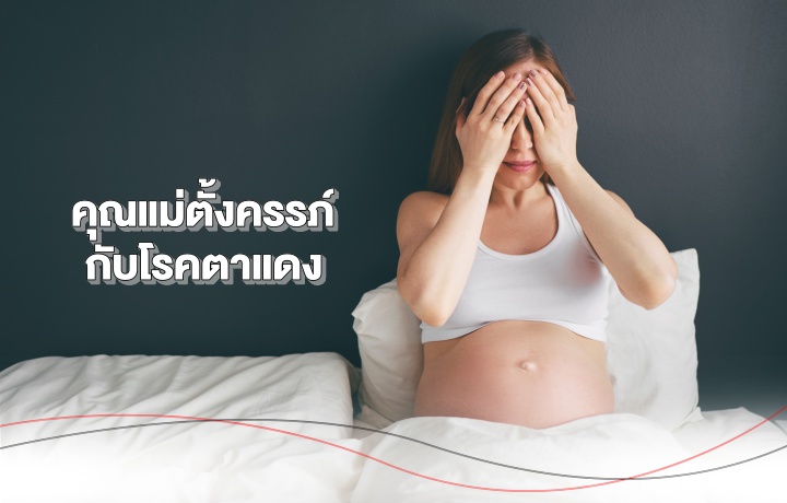 เรื่องน่ารู้คุณแม่ตั้งครรภ์กับโรคตาแดง | Health And Trend